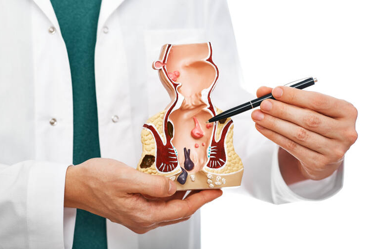 Cirugía coloproctología